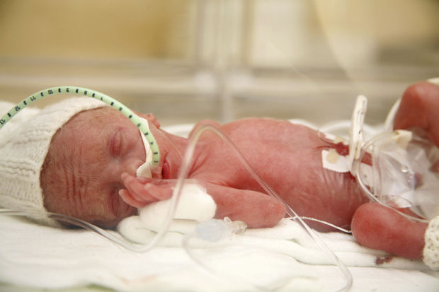 Baby's met extreem laag geboortegewicht lopen later meer risico