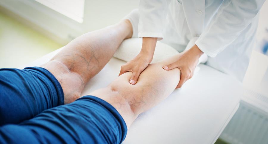 La maladie veineuse chronique : une maladie trop souvent négligée par vos patients