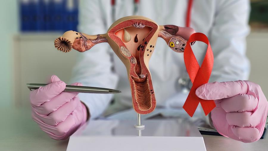 Baarmoederkanker: overleving hangt af van casusvolume ziekenhuis